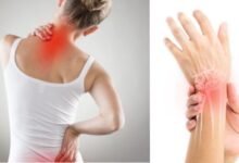 back pain physiotherapy